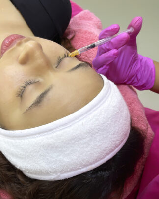MESOTERAPIA RADIANTE FACIAL