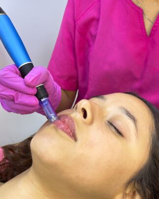 HIDRAGLOW LABIAL