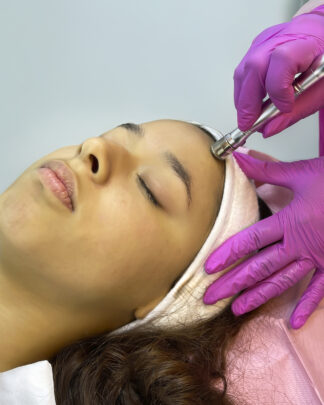 HYDRAFACIAL SMART