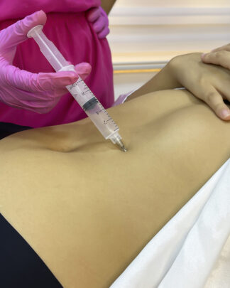 HIDROLIPOCLASIA BASIC