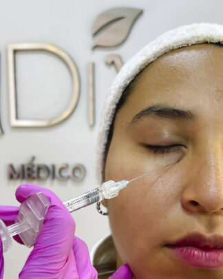 MIRADA REJUVENECIDA – ÁCIDO HIALURÓNICO EN OJERAS