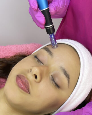MESOTERAPIA REAFIRMANTE FACIAL