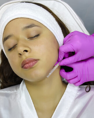 LIFTING EN CUELLO CON HILOS TENSORES
