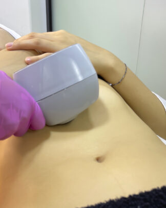 EXILIS ULTRA BODY (01 ZONA)