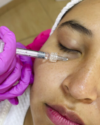 HIDRATACIÓN EN CONTORNO DE OJOS