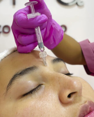 HIDRATACIÓN FACIAL 360