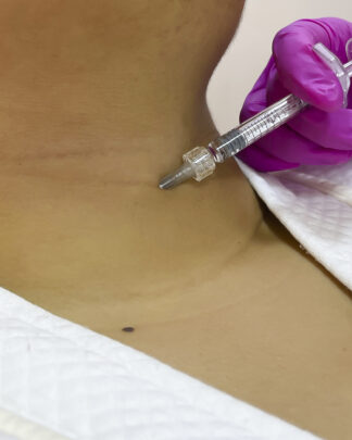 HIDRATACIÓN DE CUELLO