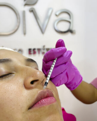 BABY BOTOX