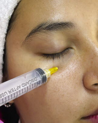REDUCCIÓN ENZIMÁTICA DE OJERAS