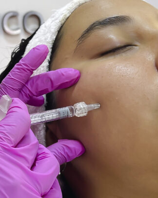 REJUVENECIMIENTO FACIAL CON BIOESTIMULADOR ELLANSÉ M