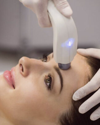 TERAPIA FACIAL CON CO2