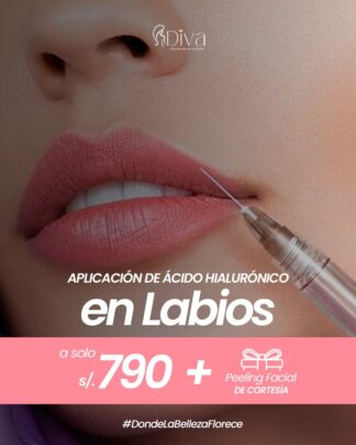 Ácido Hialurónico en Labios