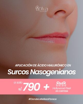 Ácido Hialurónico en Surcos Nasogenianos