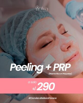 Peeling + PRP