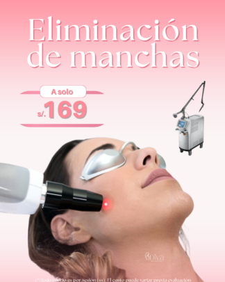Eliminación de manchas