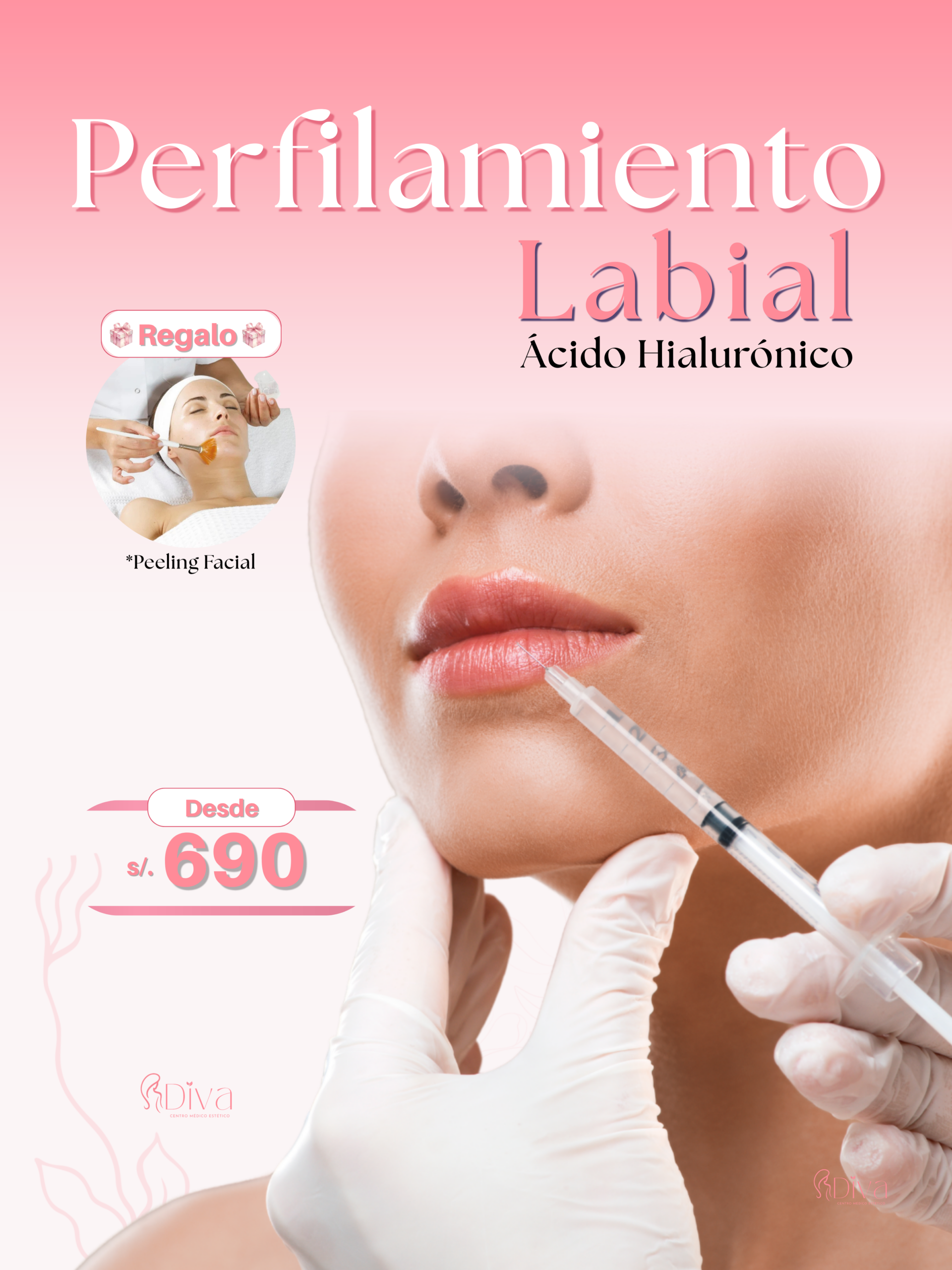 Perfilamiento Labial con Ácido Hialurónico