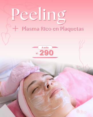 Peeling + Plasma Rico en Plaquetas (PRP)