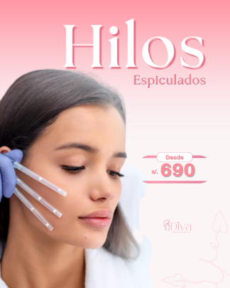 Hilos Espiculados