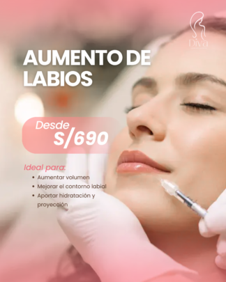 Ácido Hialurónico – Aumento de Labios