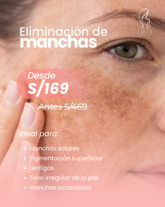 Eliminación de manchas