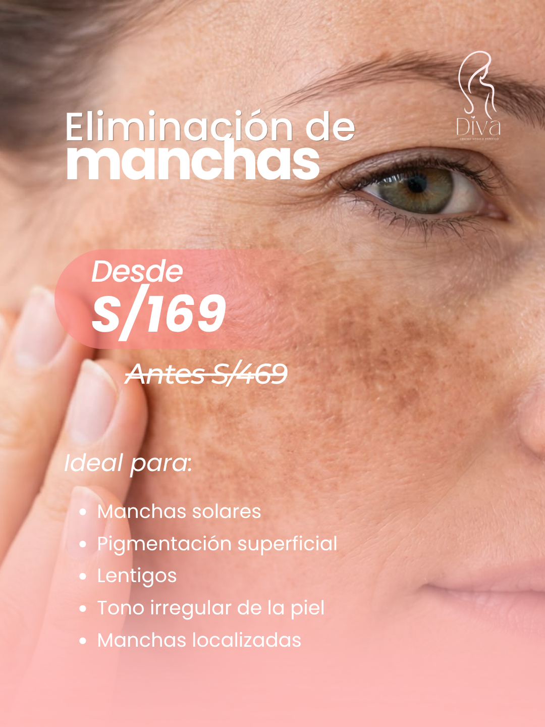 Eliminación de manchas