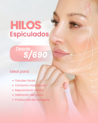 Hilos Espiculados