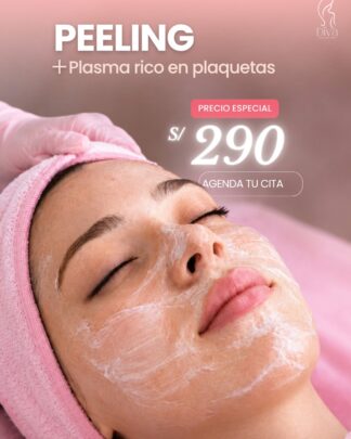 Peeling + Plasma Rico en Plaquetas (PRP)